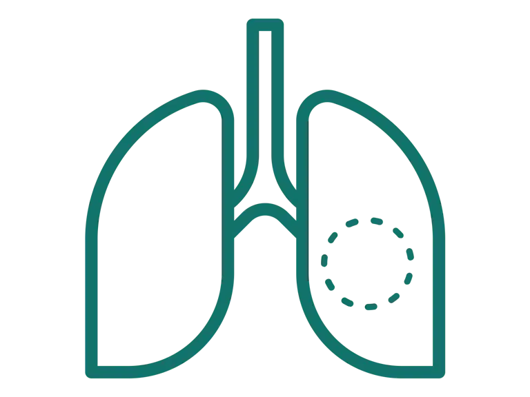 En stiliseret grøn illustration af menneskelige lunger på en transparent baggrund.